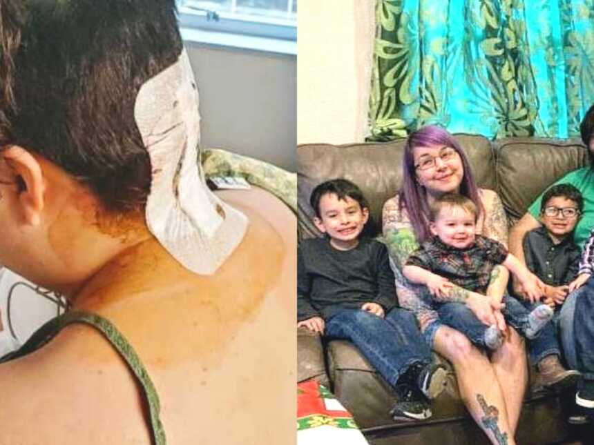 Woman after brain surgery and woman with family on couch