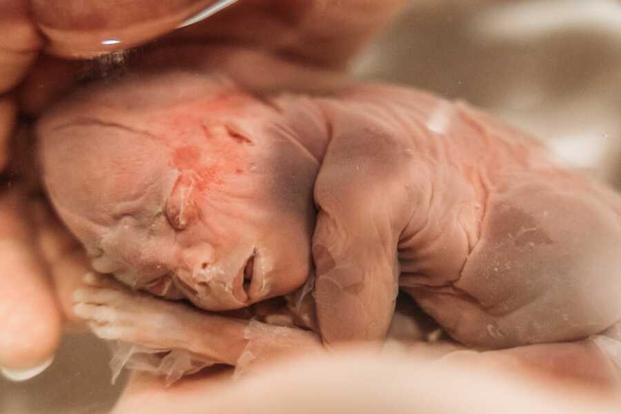 daughter swimming in the saline after birth