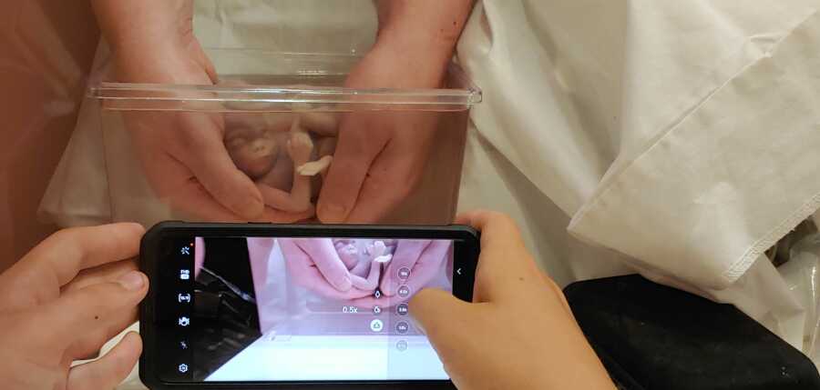 son taking pic of mom holding her daughter after birth