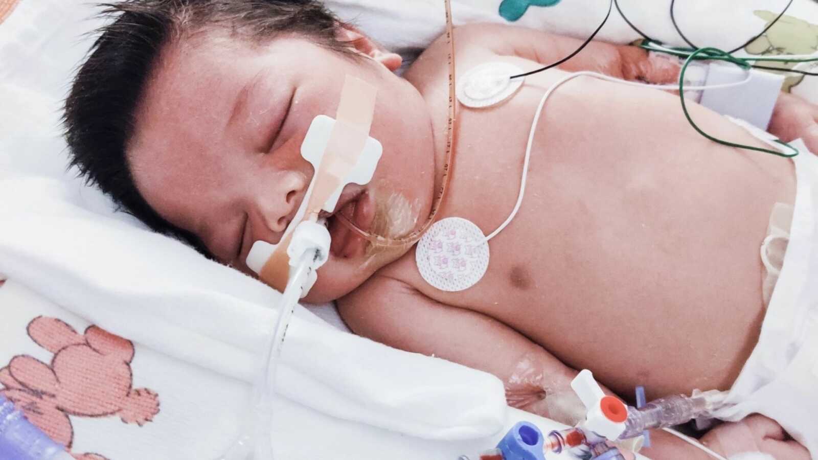 baby boy with brain damage in the hospital surviving