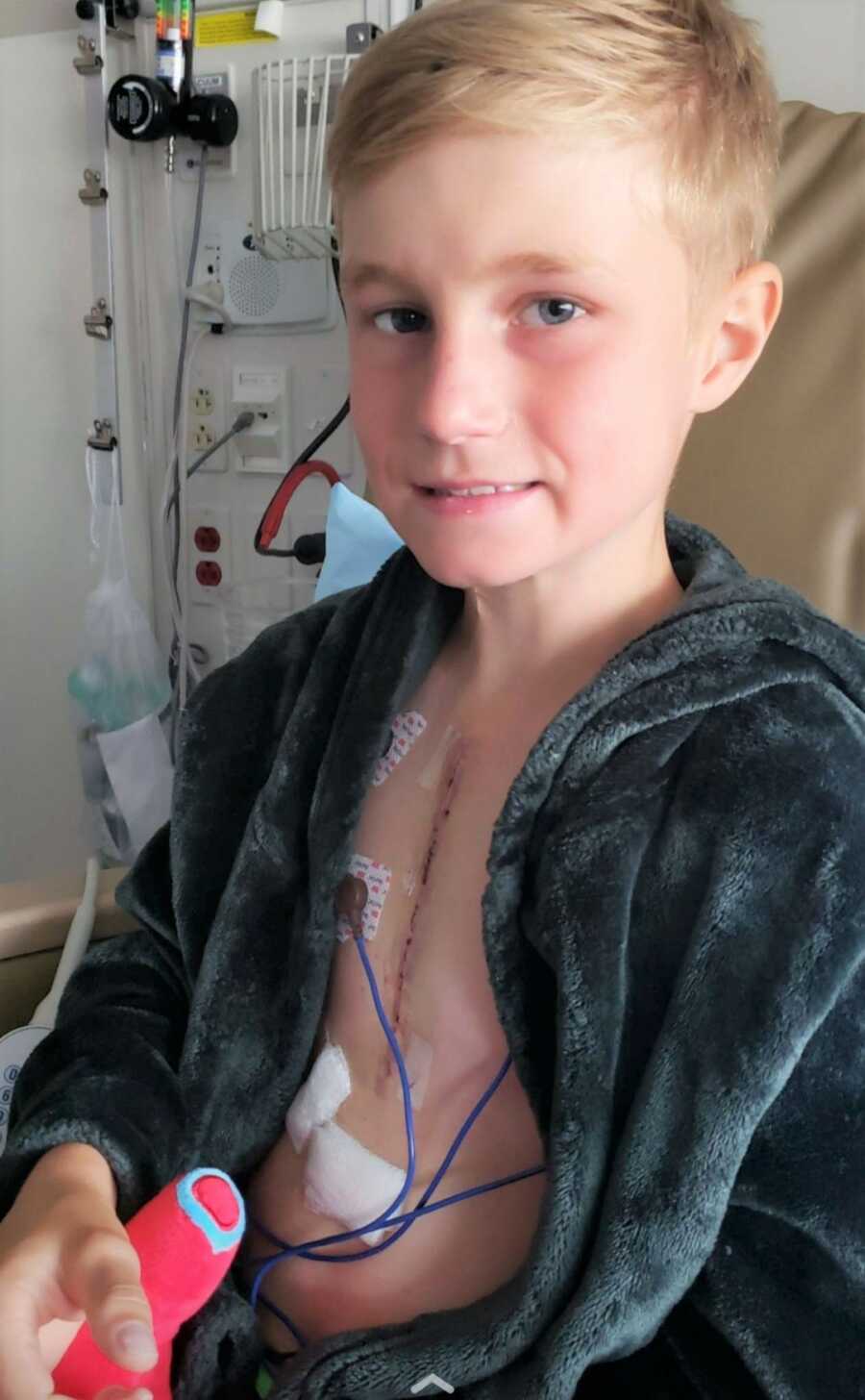 Bennett shows his scars after open-heart surgery. 