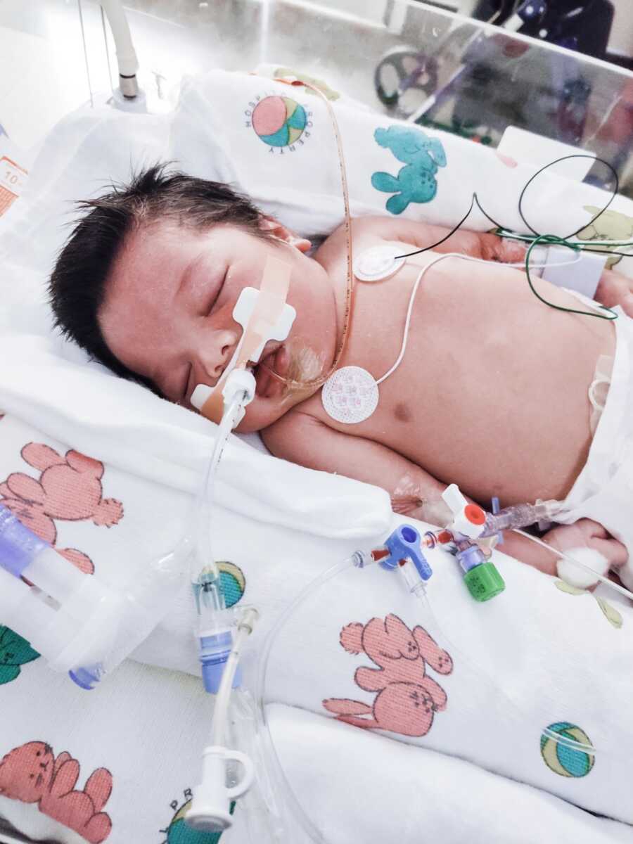 Baby boy with brain damage dying in the hospital.