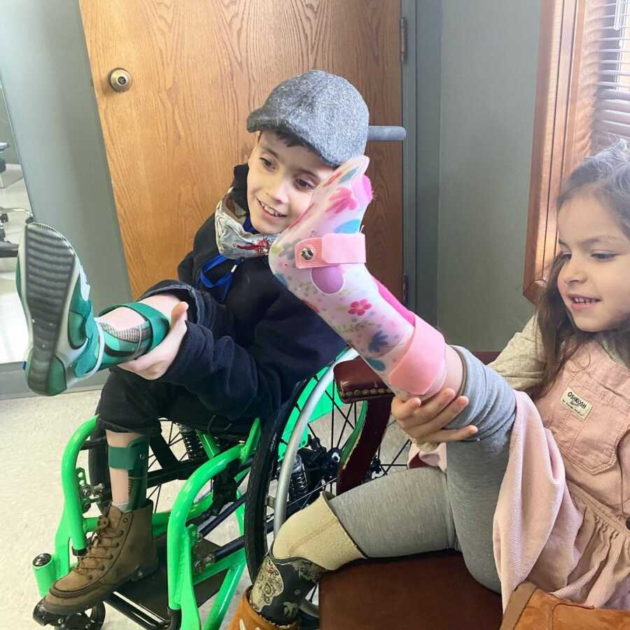 Brother and sister with limb differences show off their new prosthetics.