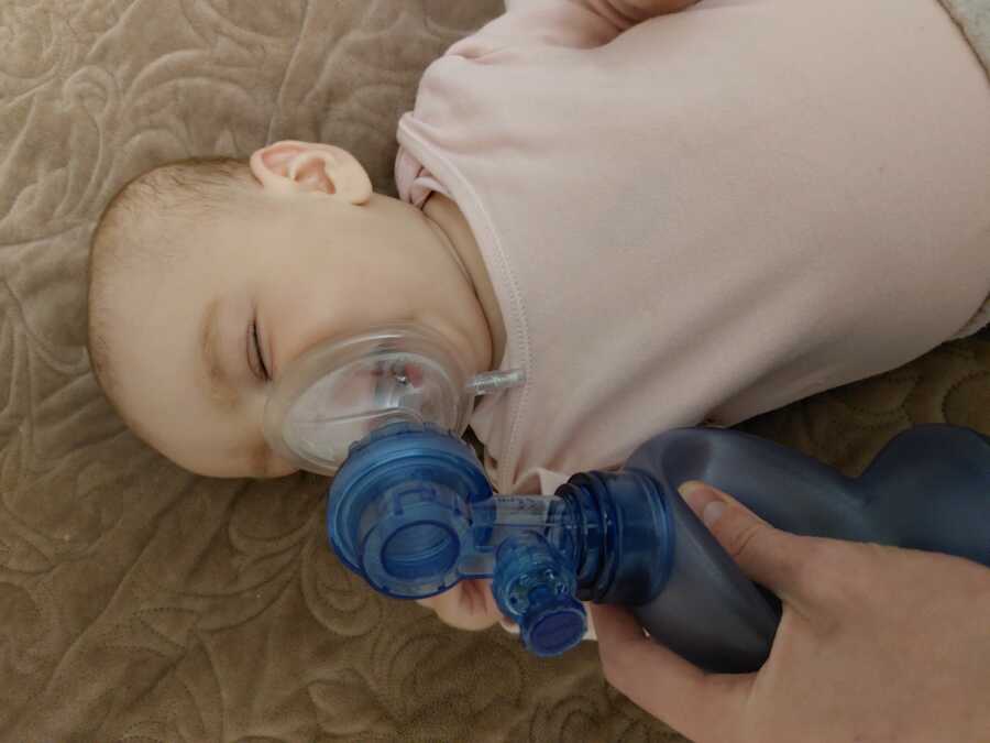 baby girl with SMA using a ventilator to breathe better 