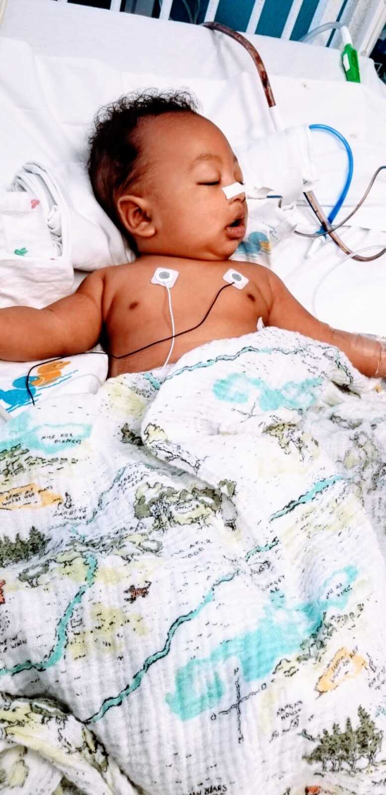 Little boy sleeps in the hospital while attached to monitors