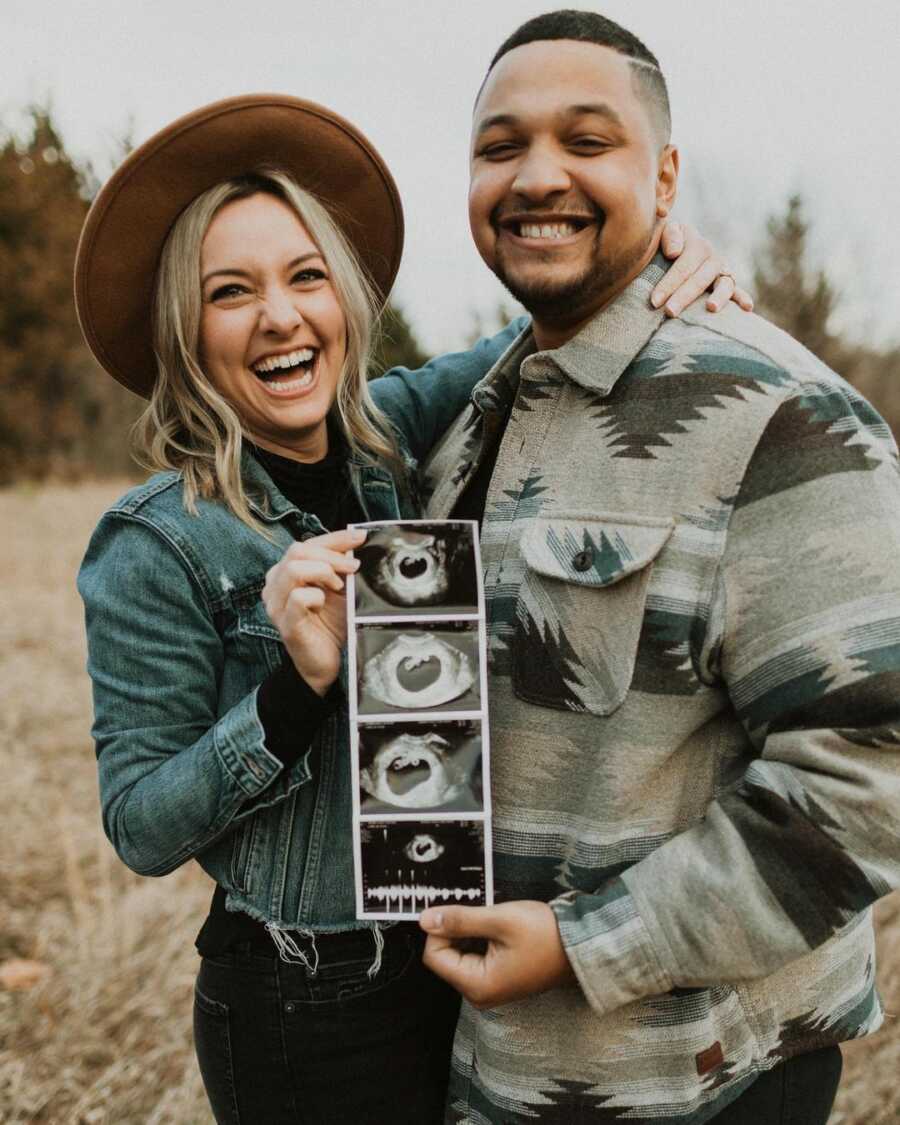 Couple shares ultrasound picture in adorable photoshoot. 