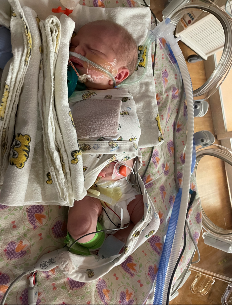 baby hooked up to machines in the ICU