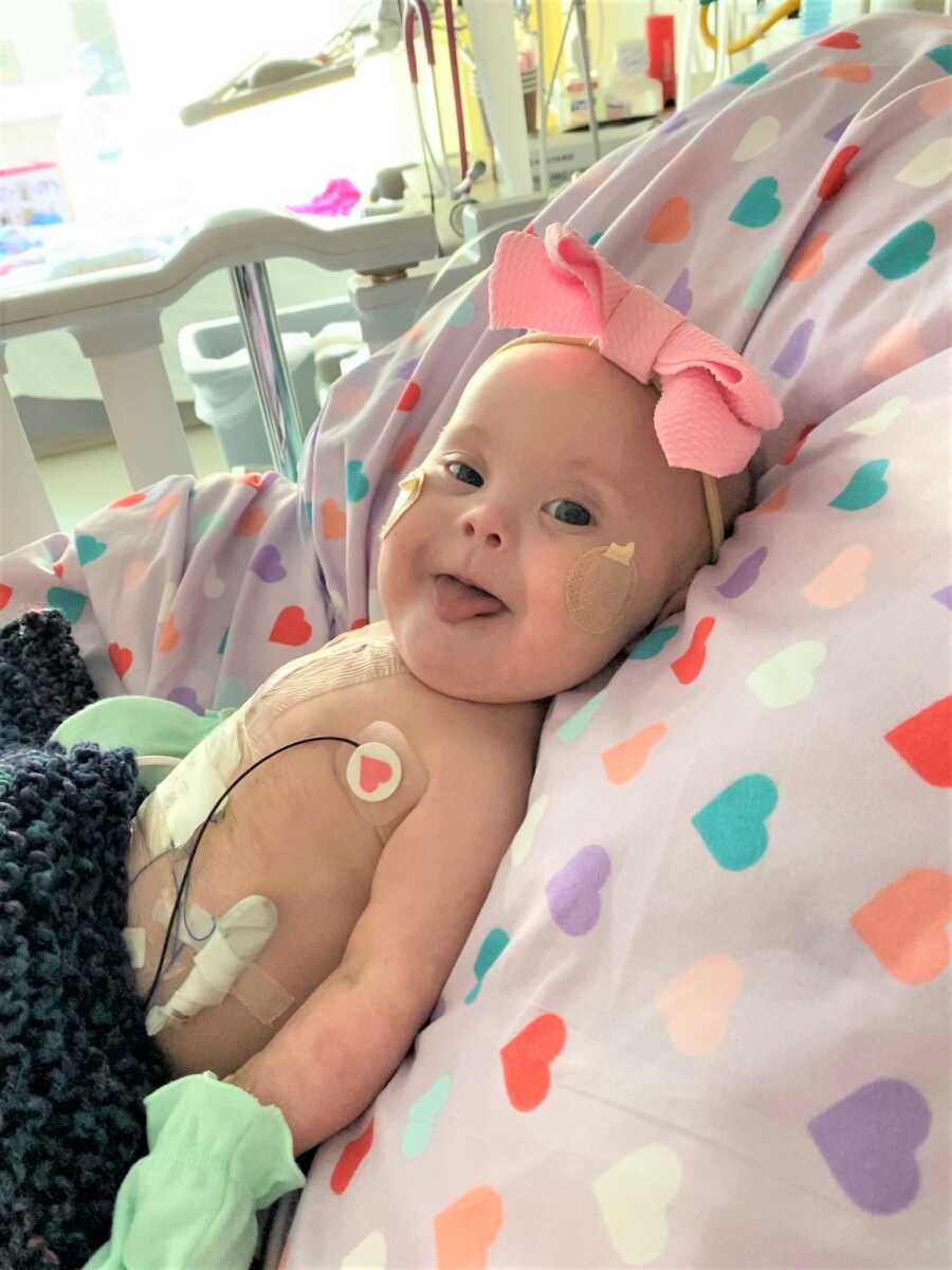 Down syndrome baby with big pink bow on her head sticking out tongue at the hospital after heart surgery