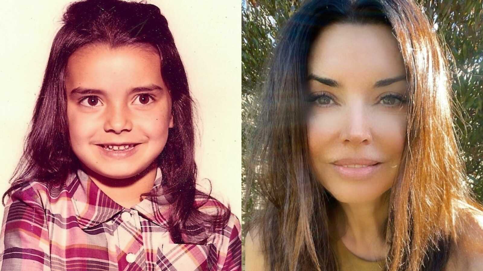 International adoptee shares photo from childhood versus how she looks now as an adult