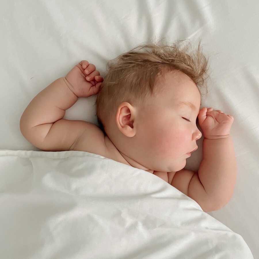 baby with limb difference sleeping
