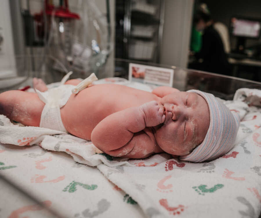 baby photo of baby with limb difference