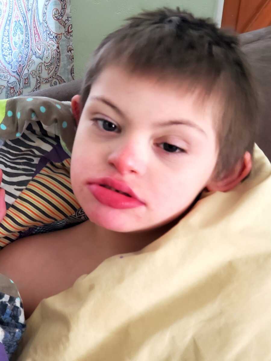 son with down syndrome looking at camera wrapped up in blankets