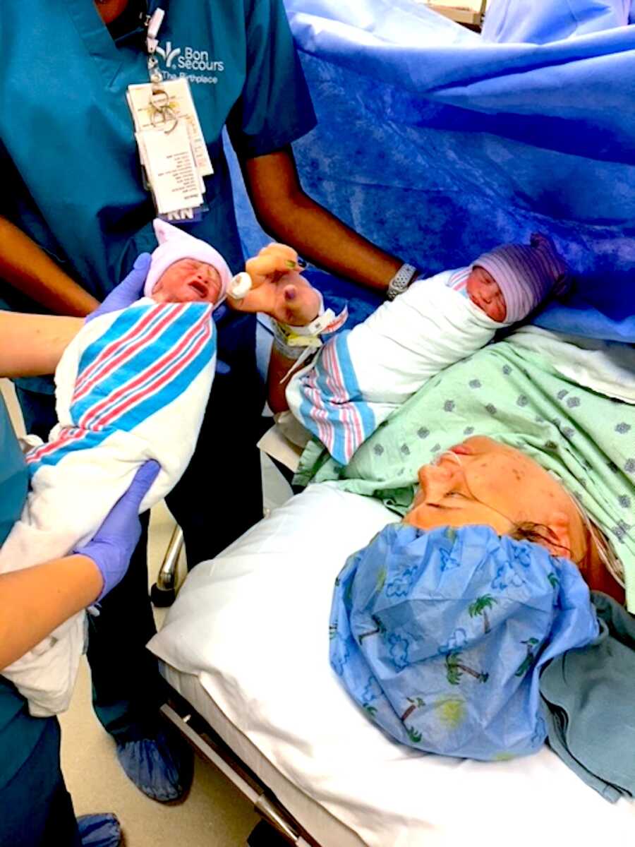 Photo of woman giving birth to twin boys via C-section