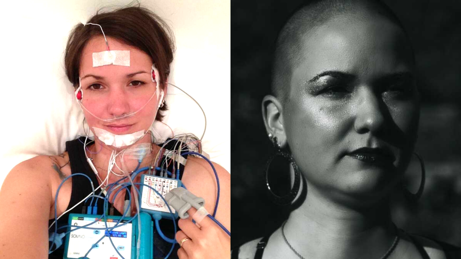 Two photos next to each other both showing the same person. Left: A woman with short brown hair lying in a bed with lots of cables on her head and chest. Right: A black and white
photo of woman with a shaved head wearing huge silver earrings and glittery make-up.