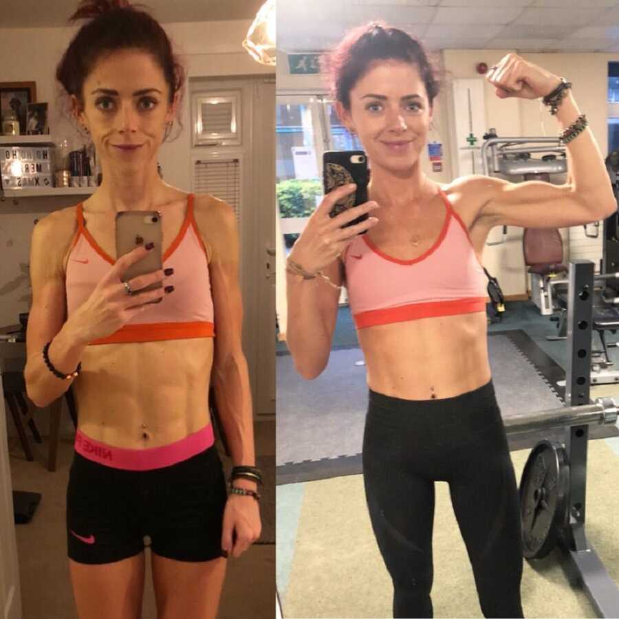 Woman with eating disorder shares before and after gym selfies.