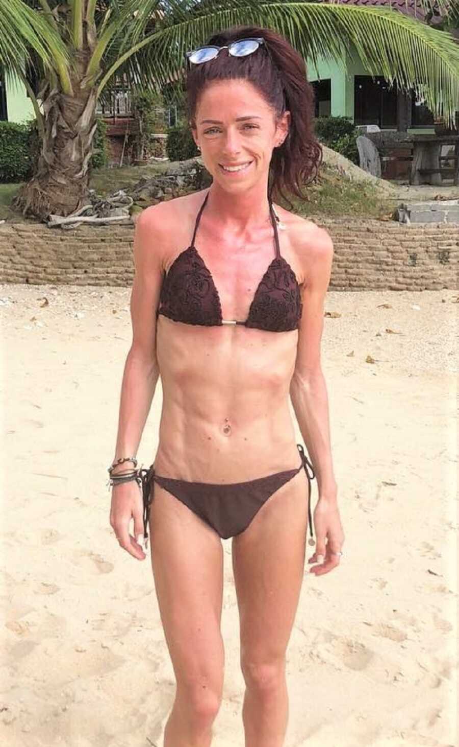 Woman struggling with eating disorder wears bikini at the beach. 
