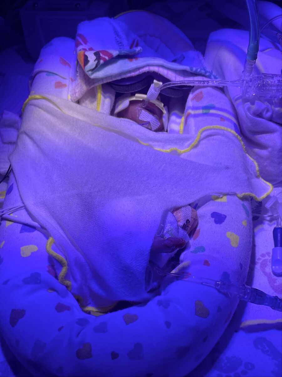 preemie baby girl in nicu wrapped in blankets under light treatment