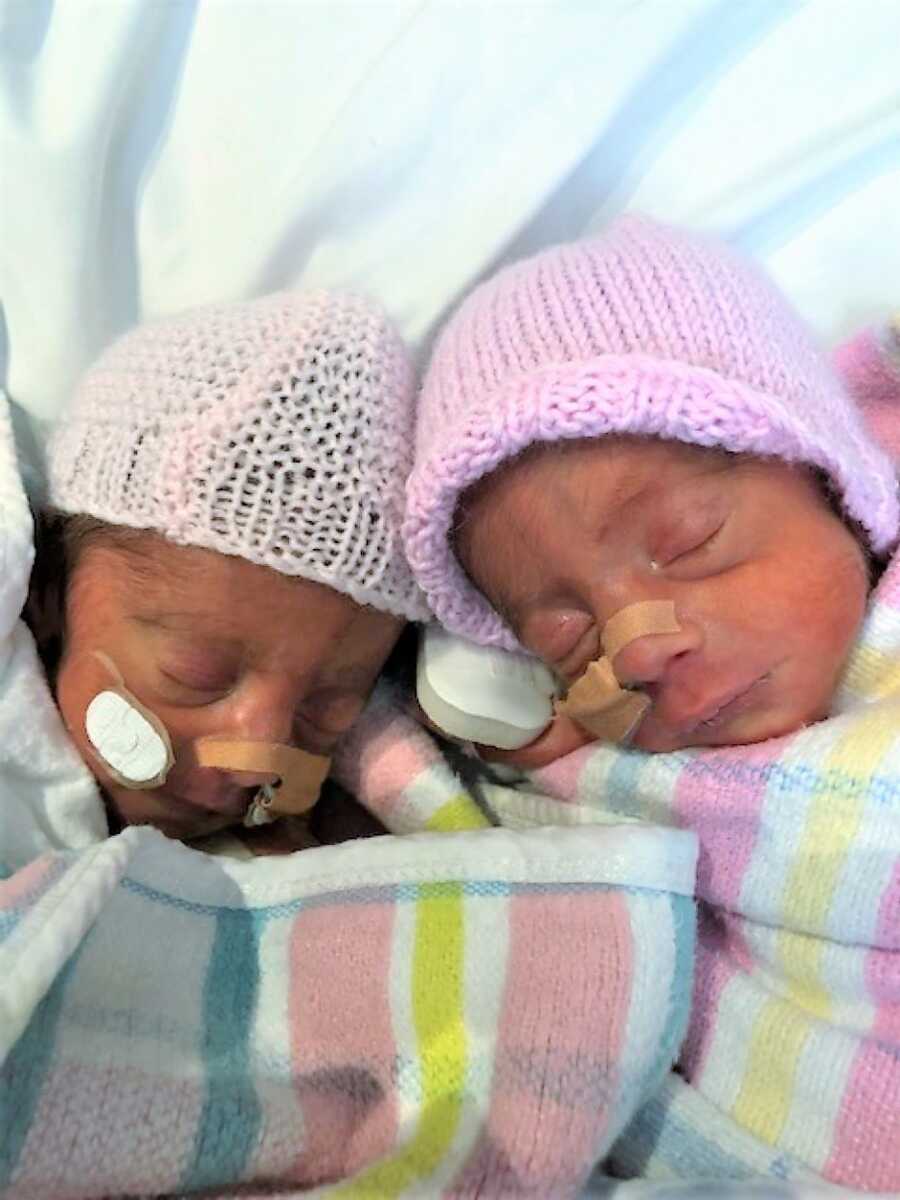 TTTS preemies at NICU after emergency C-section 