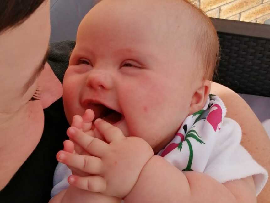 baby with down syndrome being held by her mom, smiling