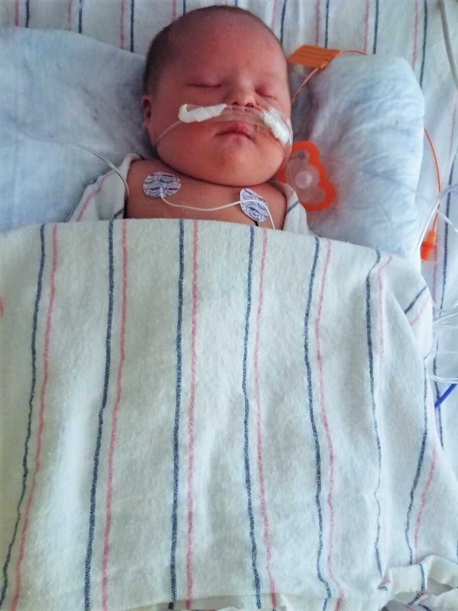 Newborn baby with Down Syndrome sleeps in hospital while connected to wires and tubes