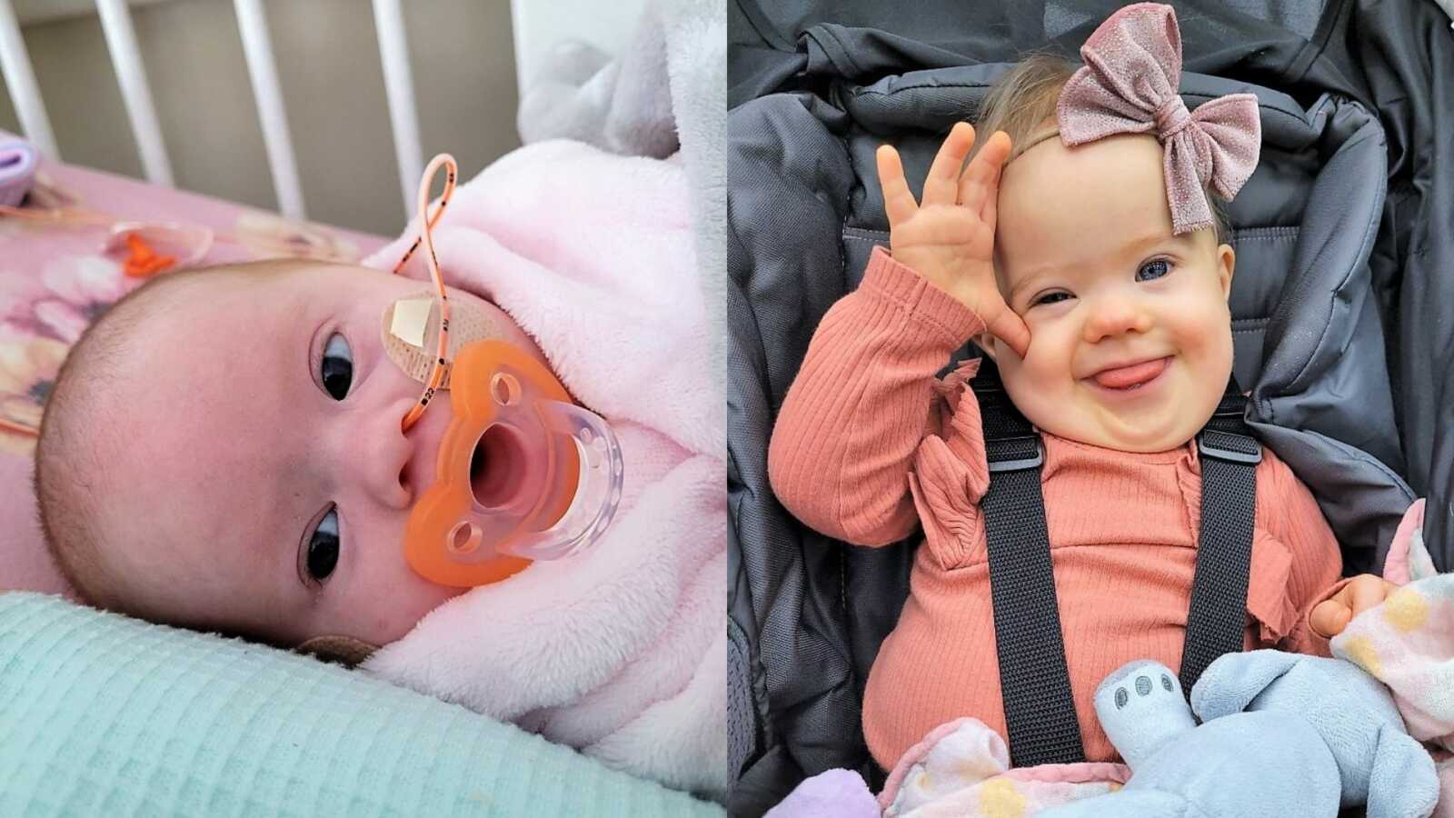 Mom shares photos of daughter born with Down Syndrome