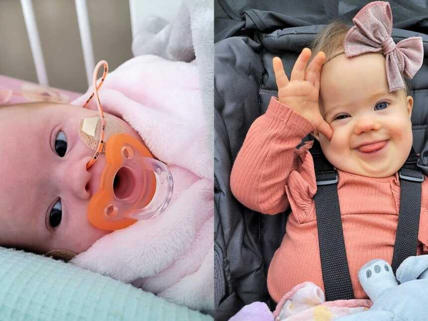 Mom shares photos of daughter born with Down Syndrome
