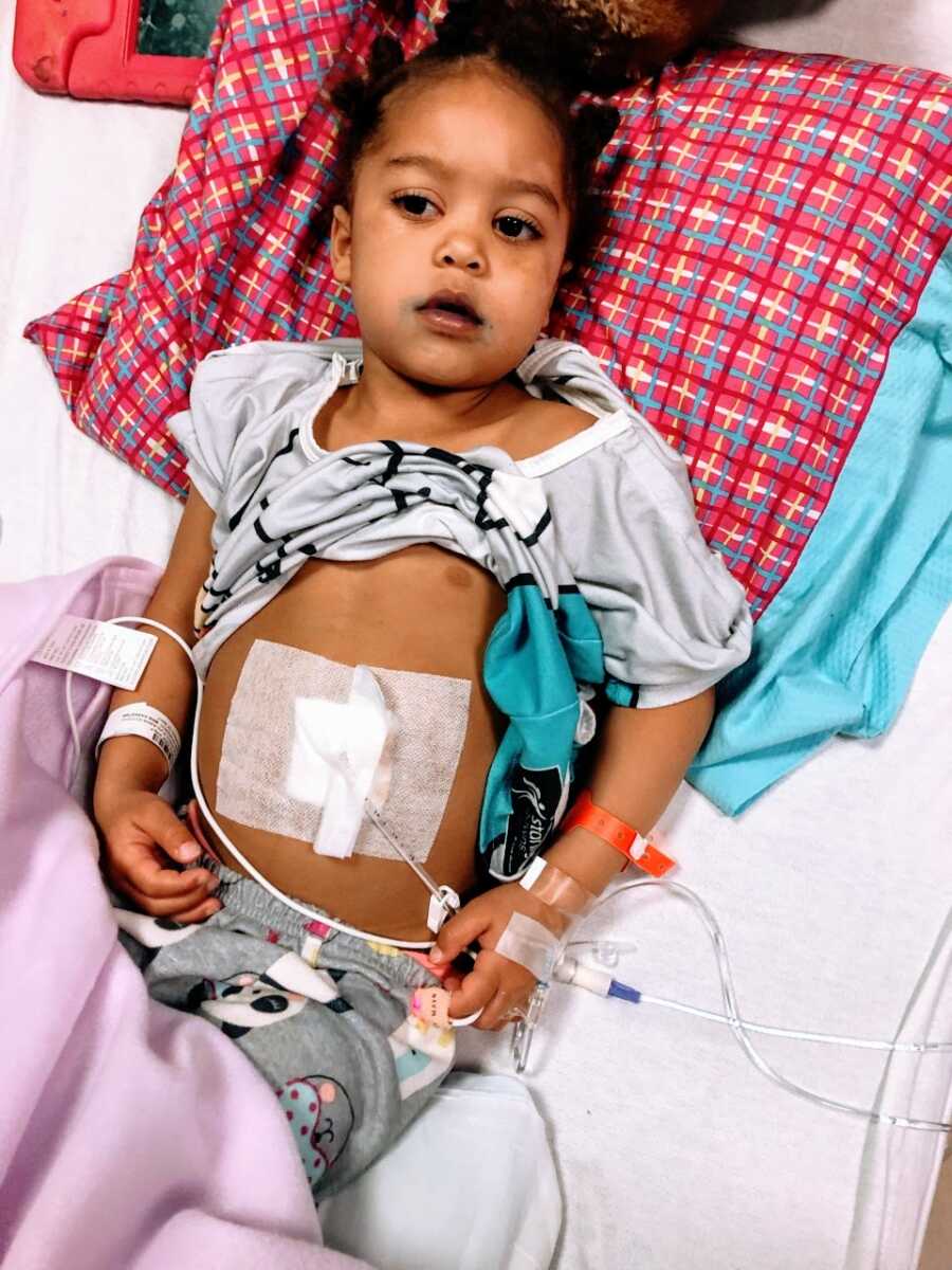 Young girl gets feeding tube attached