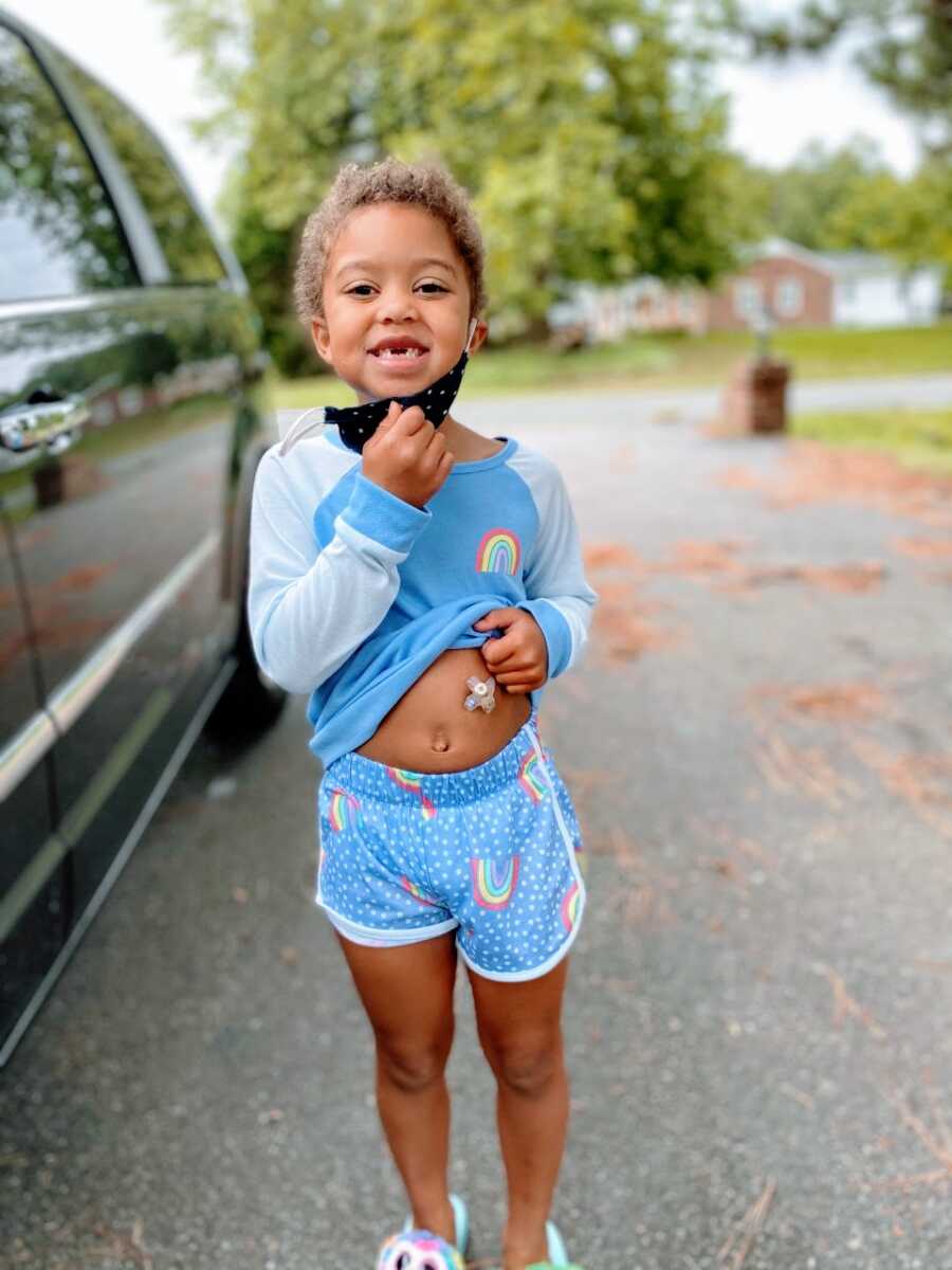 Little girl begins to gain weight thanks to feeding tube