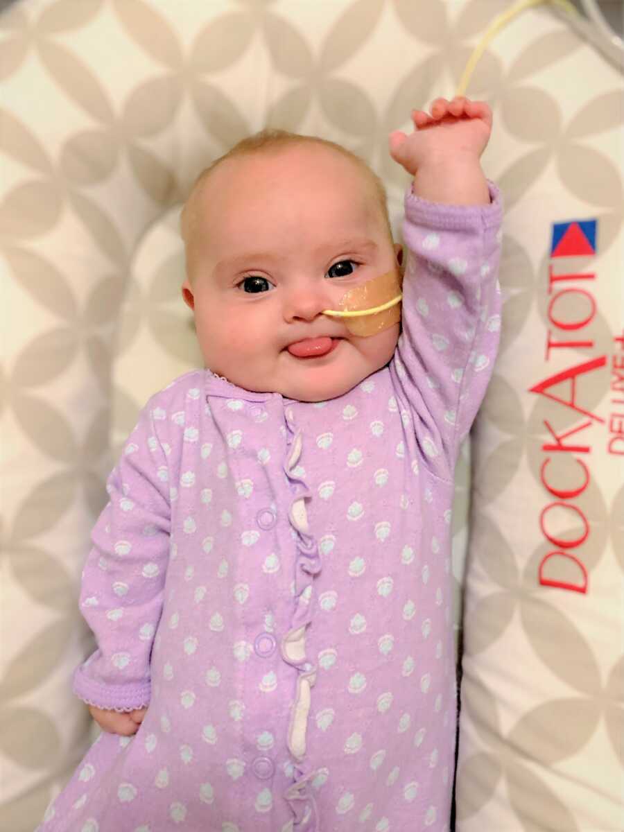 Down Syndrome baby born with heart condition wearing NG tube 