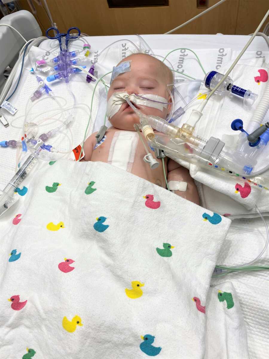 Down Syndrome baby born with heart condition recovering after heart surgery 