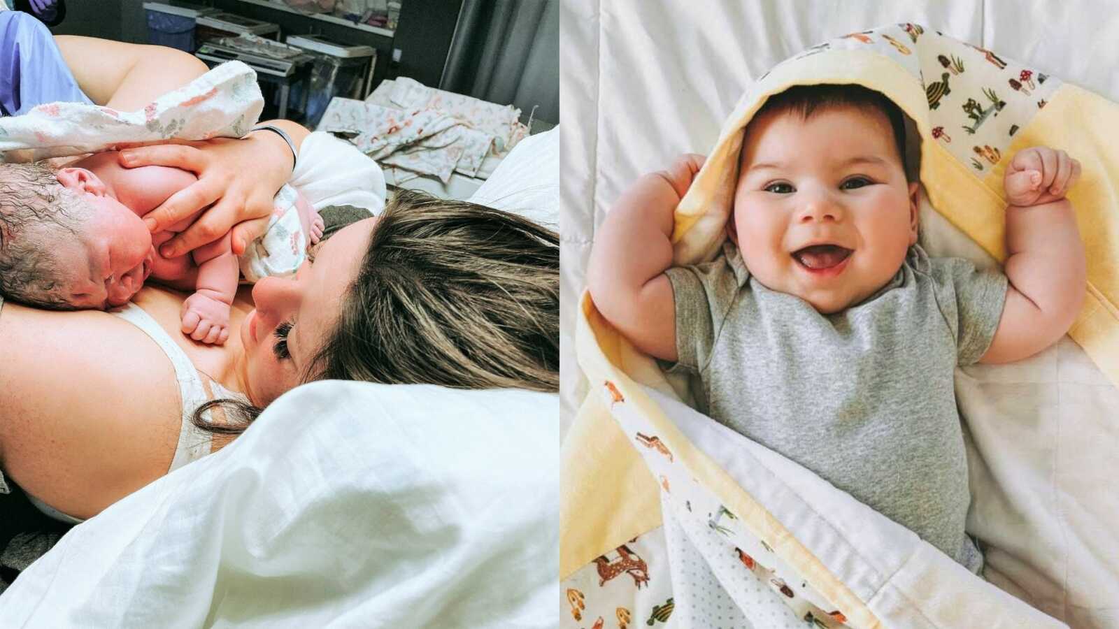 Mom shares photos from son's journey with microcephaly