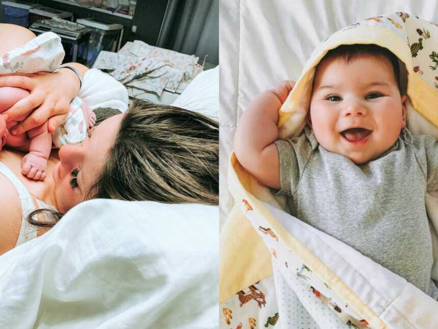 Mom shares photos from son's journey with microcephaly