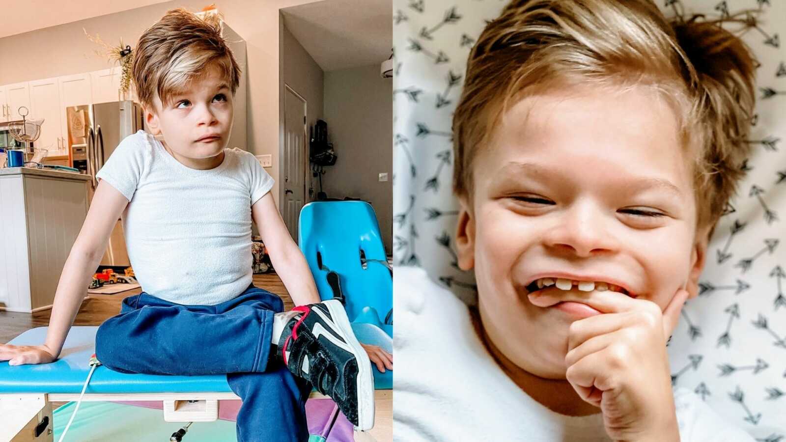 Special needs mom shares photos of her son with rare condition