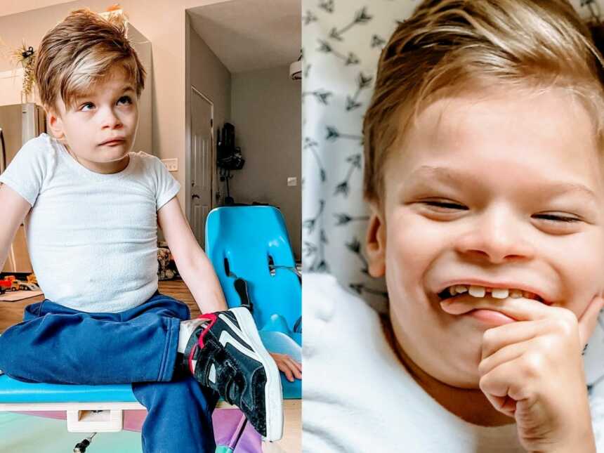 Special needs mom shares photos of her son with rare condition