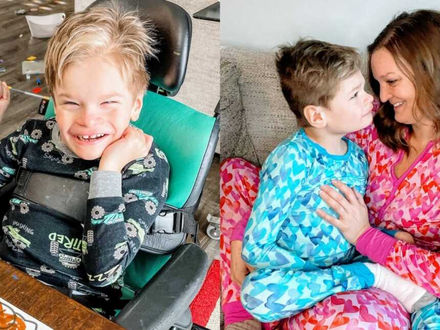 Special needs mom shares sweet photos with her son with CDG