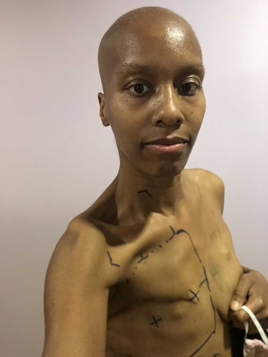 woman taking a selfie after cancer treatmnet