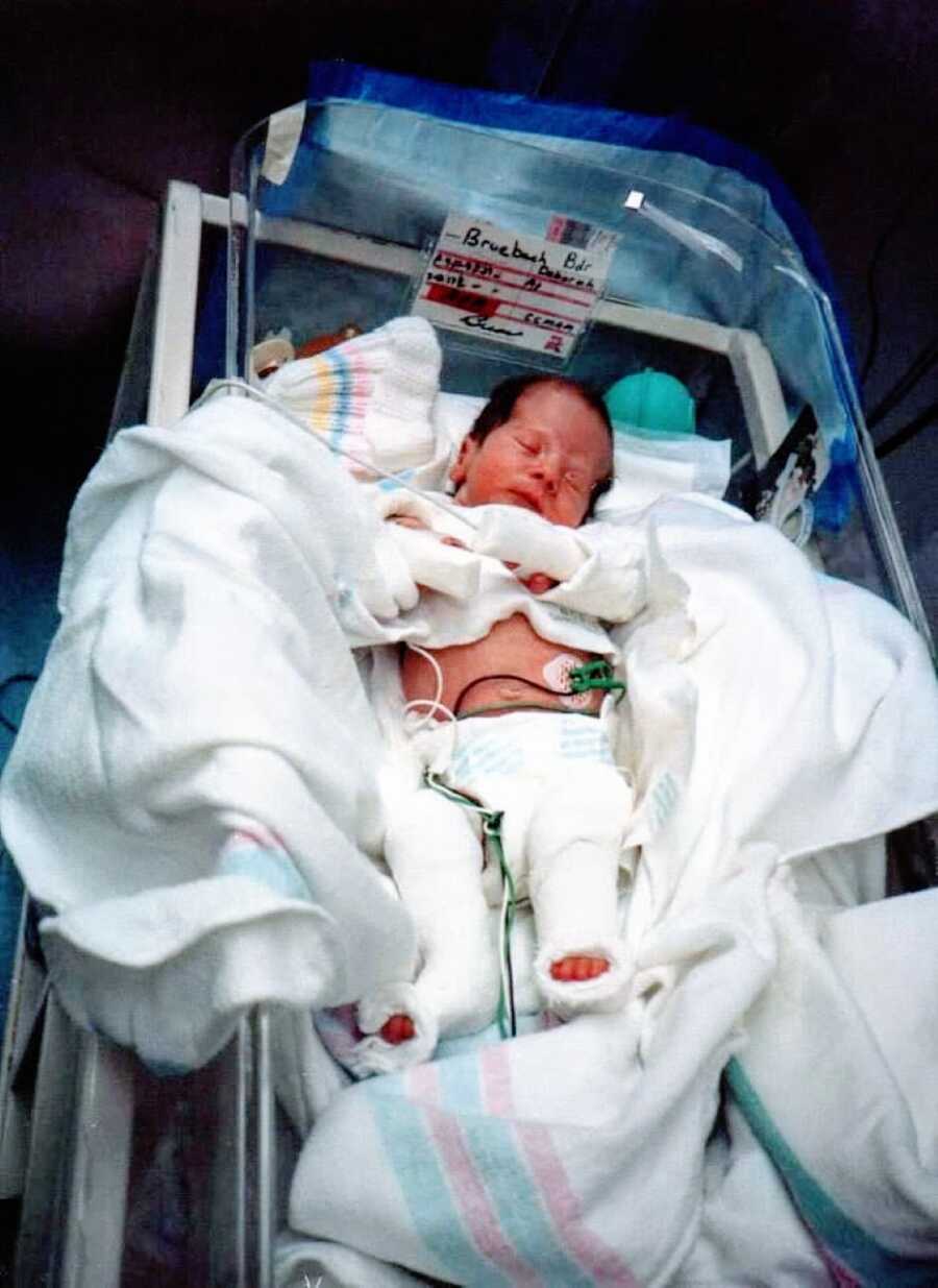 Newborn baby girl lays in the NICU ward while attached to wires