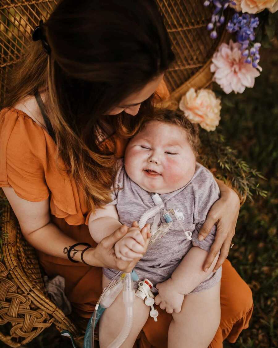 woman cradling her baby with special needs