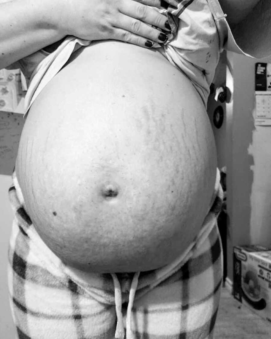 Pregnant woman takes an up-close photo of her belly bump, showing off her stretch marks