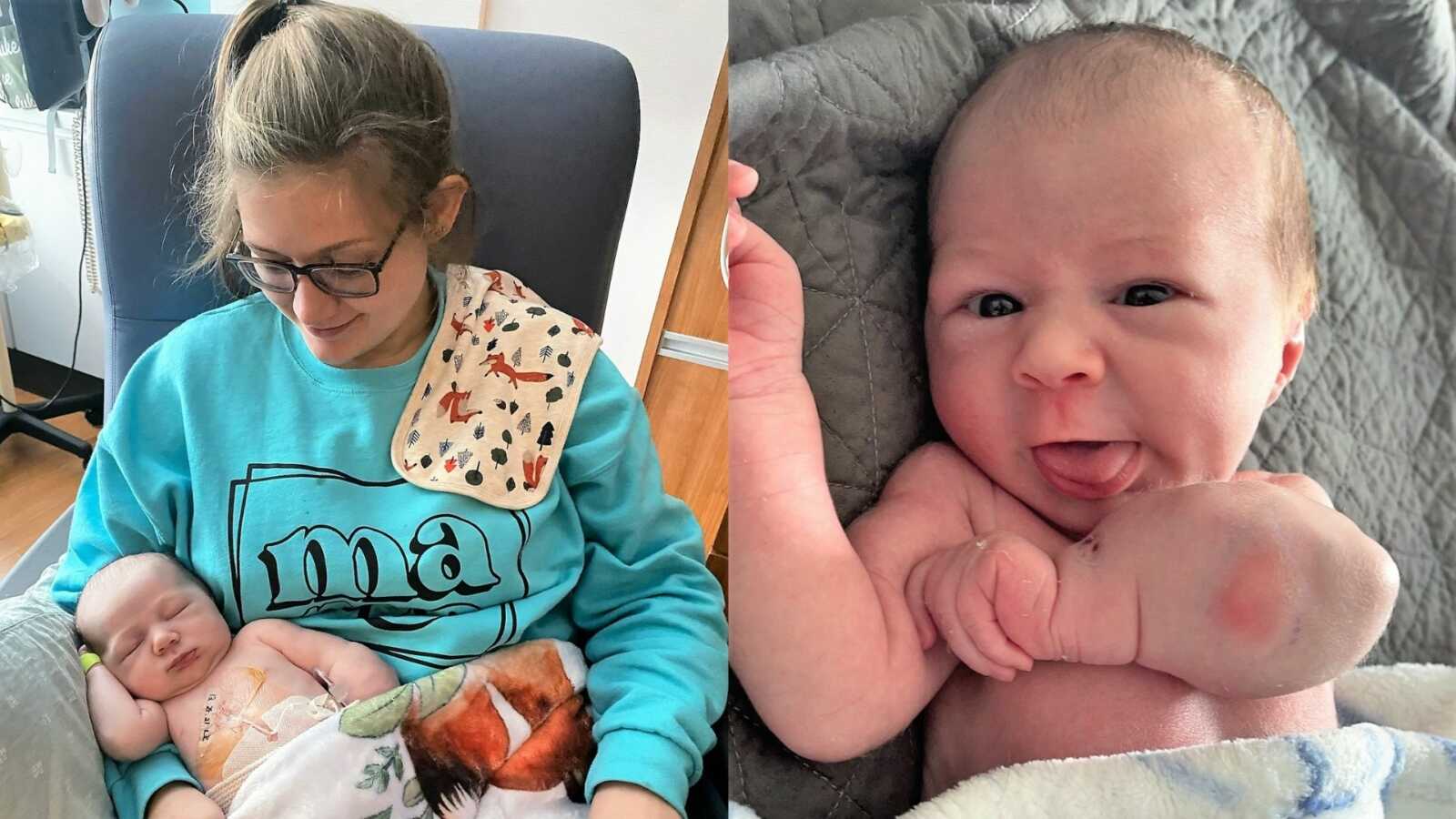 On the left, mom holds newborn baby. On the right, mom takes photo of newborn baby's swollen arm