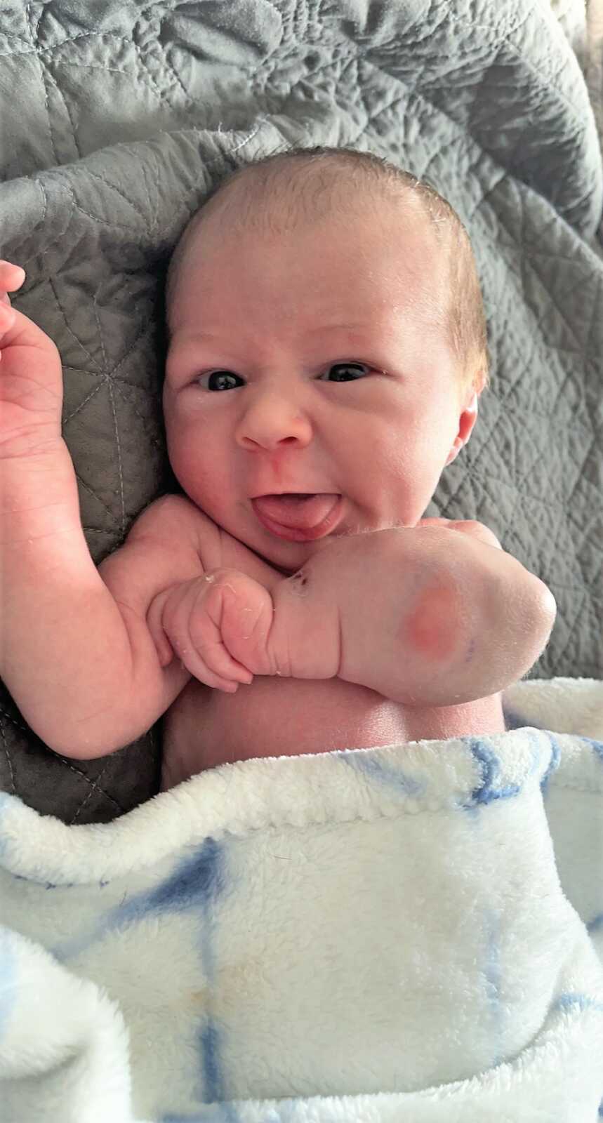 Newborn baby with inflamed arm due to cancer