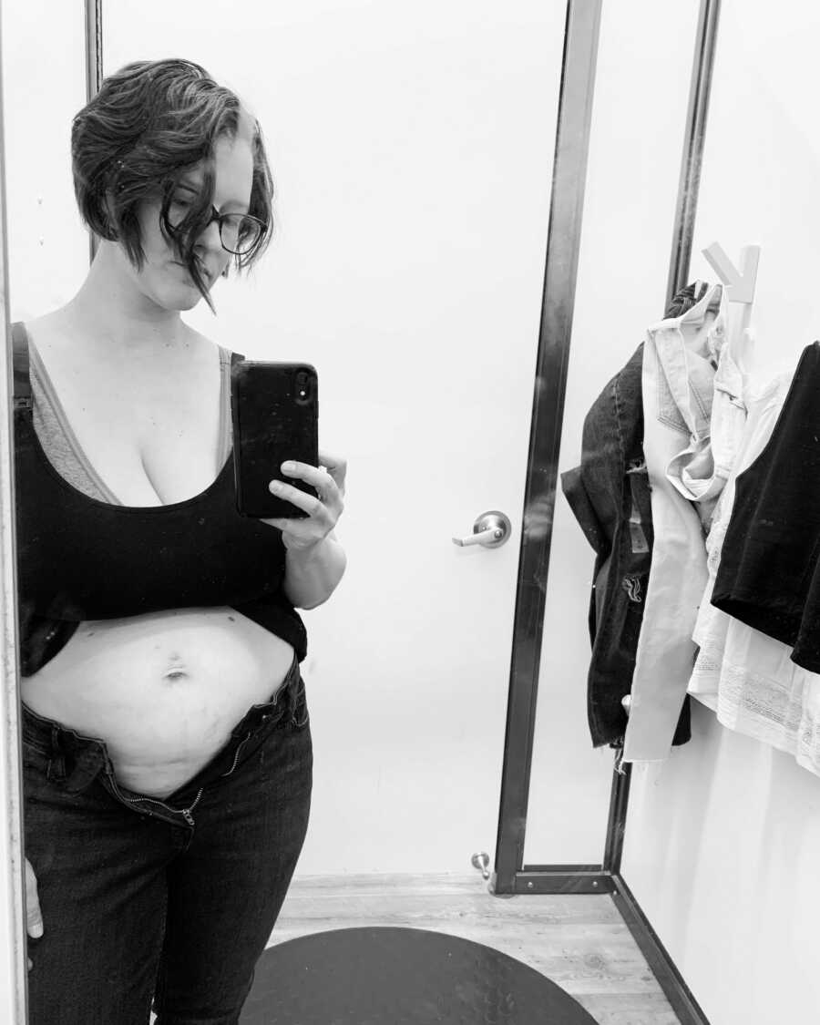 mom's postpartum body she has taken a picture of