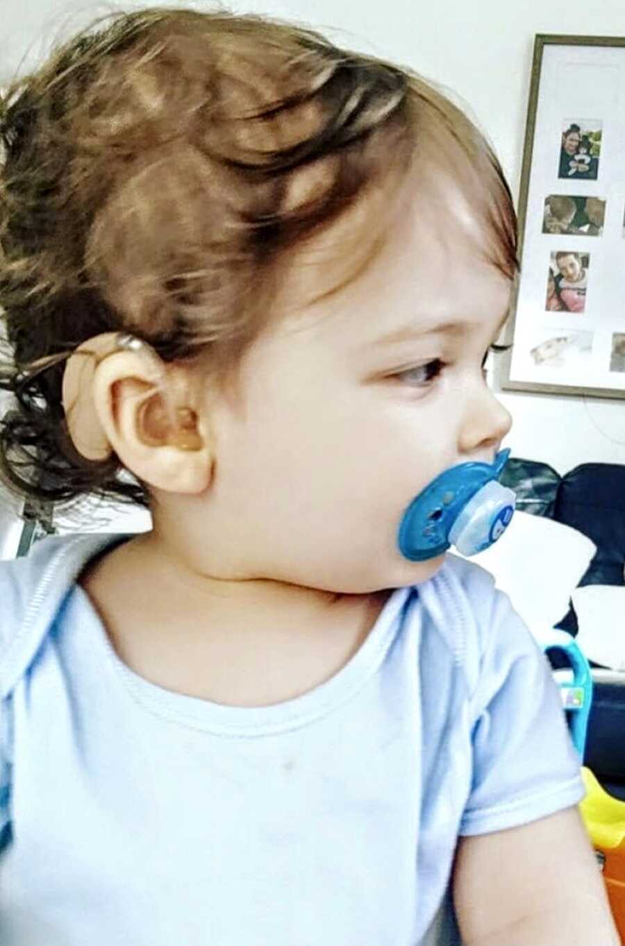 Toddler with cochlear implants sucks on a blue pacifier in a blue onesie