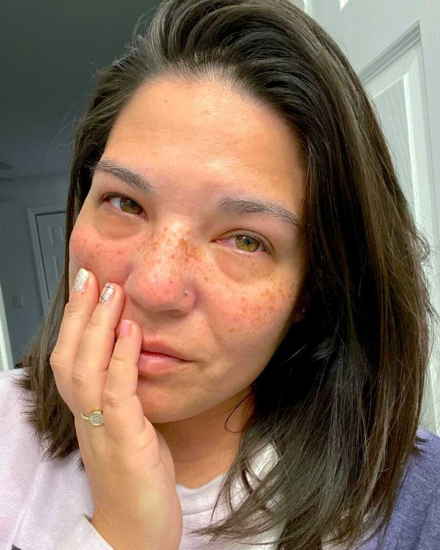 mom with anxiety and depression takes a selfie with puffy eyes from crying with a hand on her face