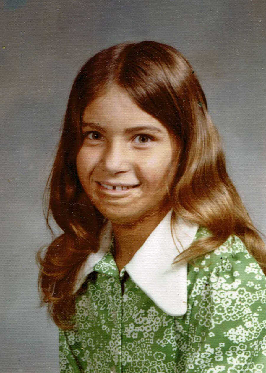 little girl with burn scars in school photo