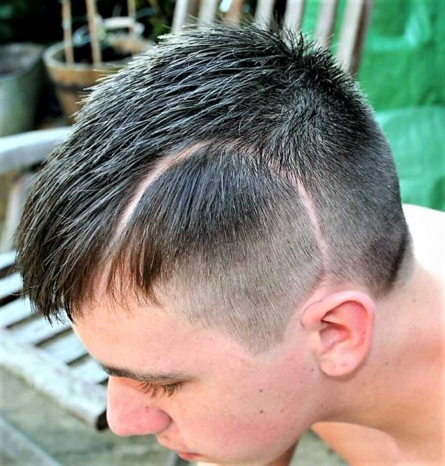 young man with a long scar on the left side of his face 