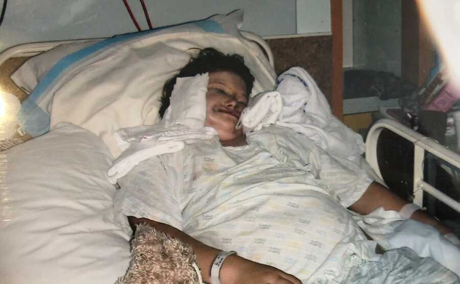 little girl in bed after smile surgery