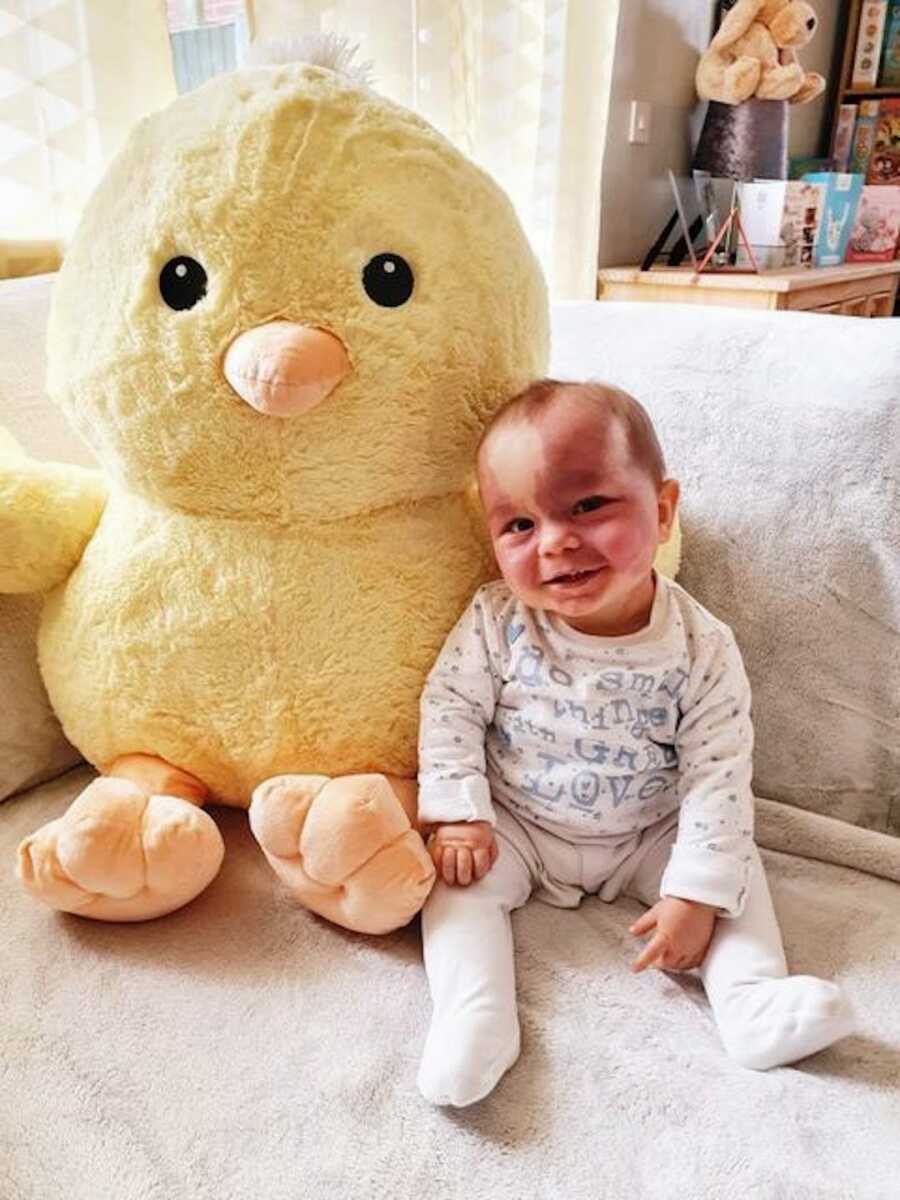 girl with sturge-weber syndrome smiles with a stuffed duck