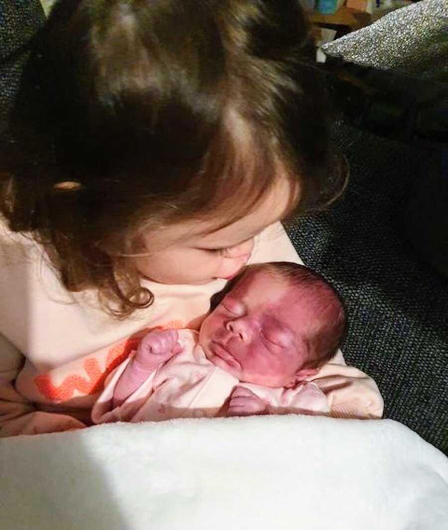girl with sturge-weber syndrome meeting her older sister for the first time