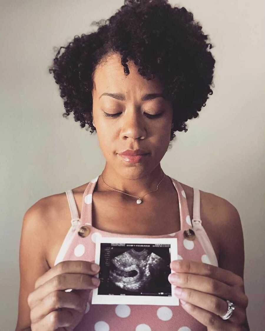 woman holds an ultrasound image up